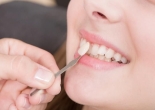 Bọc răng sứ có được vĩnh viễn không?